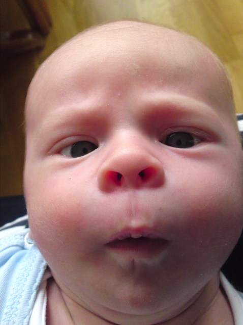 Perspective on percentages